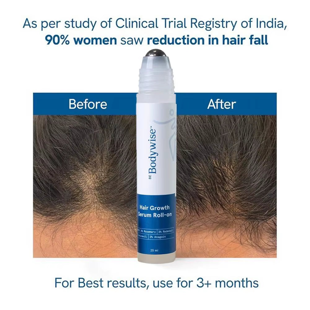 25Ml 3% Rosemary Hair Growth Serum - Deep Scalp Nourishment Frizz Control Strengthen Hair Roots Hair Care Essence Oil