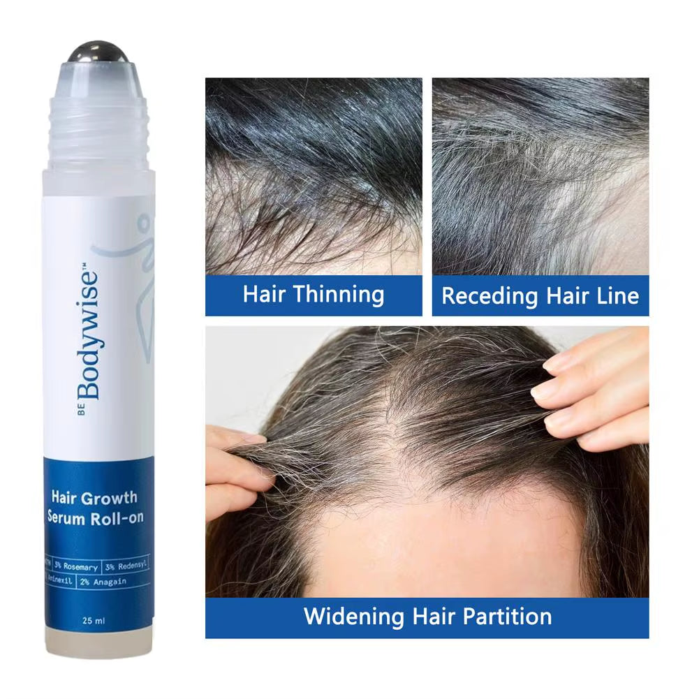 25Ml 3% Rosemary Hair Growth Serum - Deep Scalp Nourishment Frizz Control Strengthen Hair Roots Hair Care Essence Oil
